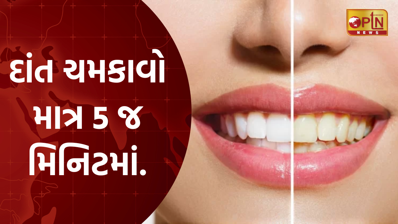 દાંત ચમકાવો માત્ર 5 જ મિનિટમાં.